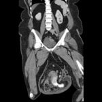 Creative Commons images