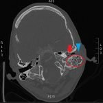 Creative Commons images