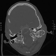 Creative Commons images