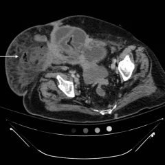 Creative Commons images