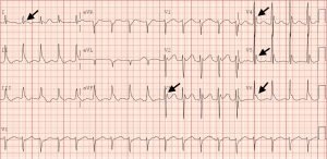 Creative Commons images