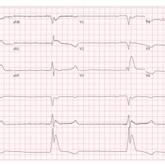 Creative Commons images