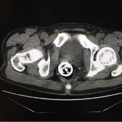 Creative Commons images