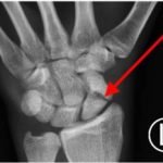 Creative Commons images