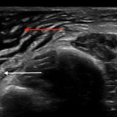 Creative Commons images