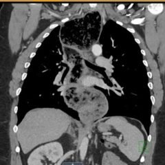 Creative Commons images