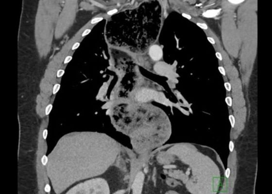 Creative Commons images