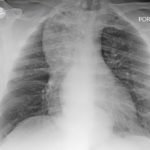 Creative Commons images