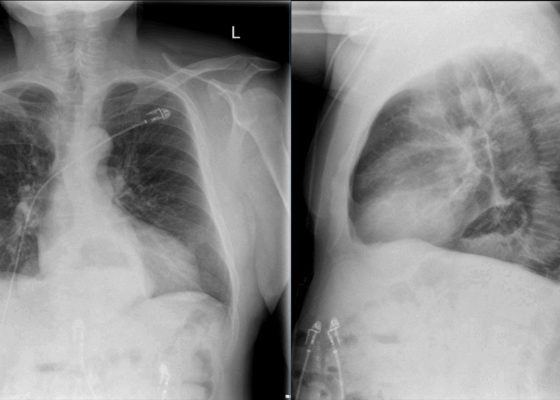 Creative Commons images