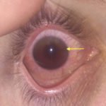 Creative Commons images