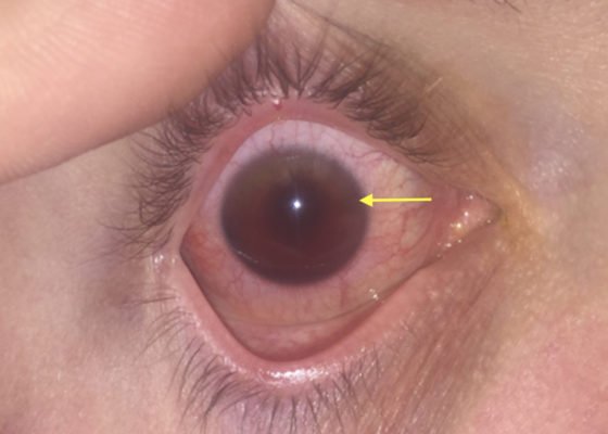 Creative Commons images