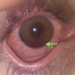 Creative Commons images