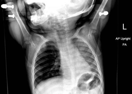 Creative Commons images