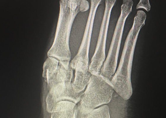 Creative Commons images