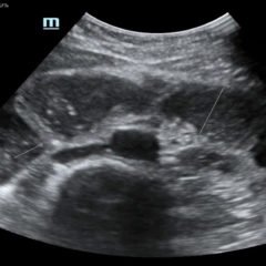 Creative Commons images