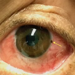 Creative Commons images