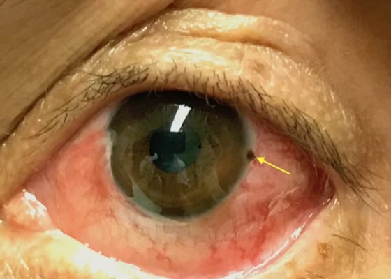 Creative Commons images