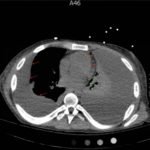 Creative Commons images