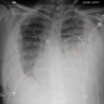 Creative Commons images