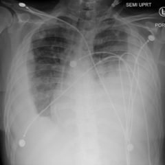 Creative Commons images