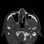 Creative Commons images