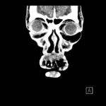 Creative Commons images