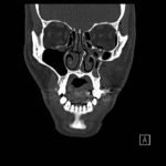 Creative Commons images