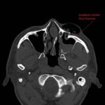 Creative Commons images