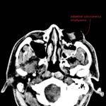 Creative Commons images