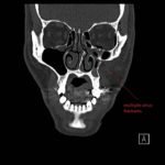 Creative Commons images