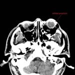 Creative Commons images