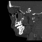 Creative Commons images