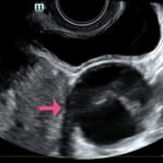 Creative Commons images