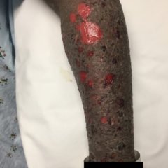 Creative Commons images