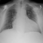 Creative Commons images