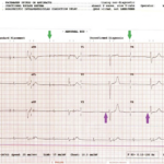 Creative Commons images