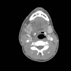 Creative Commons images