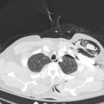 Creative Commons images