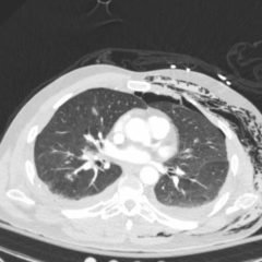 Creative Commons images