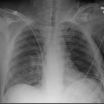 Creative Commons images