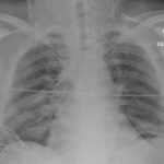 Creative Commons images