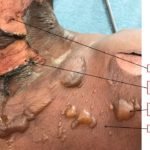 Creative Commons images