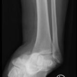 Creative Commons images