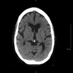 Creative Commons images