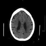 Creative Commons images