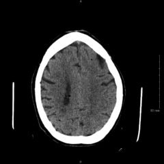 Creative Commons images