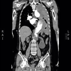 Creative Commons images