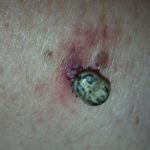 Creative Commons images