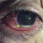 Creative Commons images