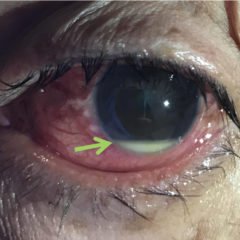 Creative Commons images